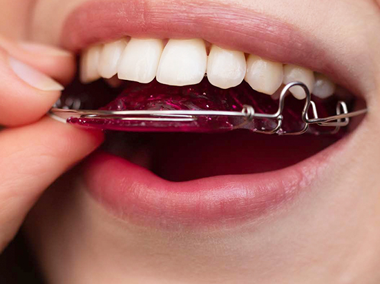 a-que-se-debe-el-color-de-los-dientes