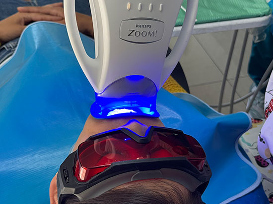 ¿Qué esperar del blanqueamiento dental?