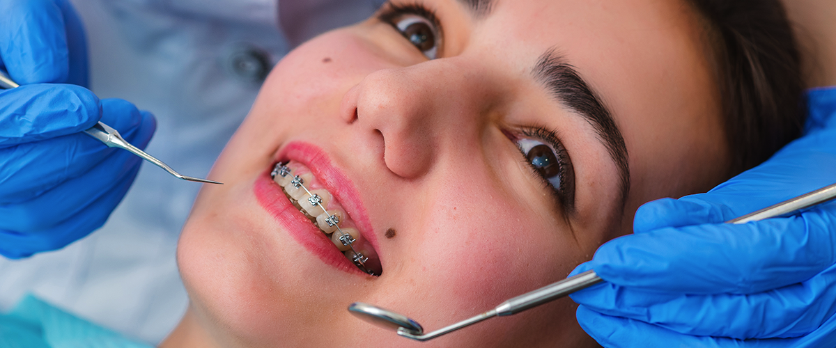 Consecuencias de no extraer la muela del juicio